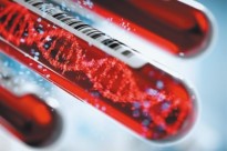 Bild 1 von my-Budget <br>Blood RNA Mini Kit