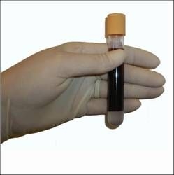 Bild 1 von my-Budget <br>Blood DNA Mini Kit